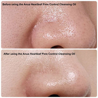 Anua - Heartleaf Pore control cleansing oil