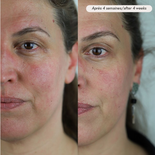 Facial oil PAX - sensitive &amp; acne skin