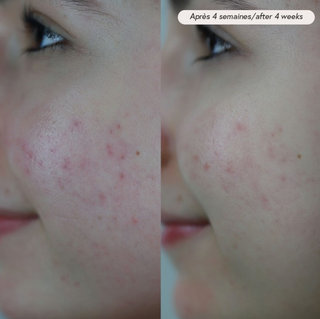 Facial oil PAX - sensitive &amp; acne skin