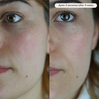 Facial oil PAX - sensitive &amp; acne skin