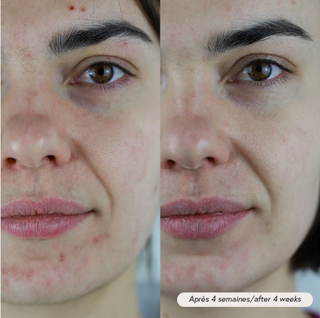 Facial oil PAX - sensitive &amp; acne skin
