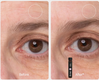 Collagen Advance + shots (28x25ml)