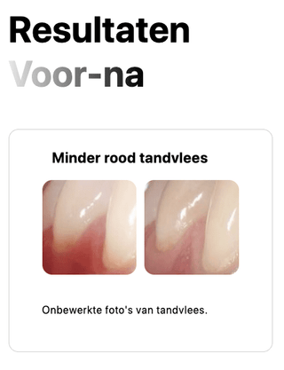 REGENERATING tandvlees serum-gel - Bio'ty Lab