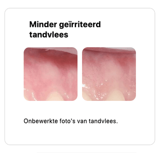 REGENERATING tandvlees serum-gel - Bio'ty Lab