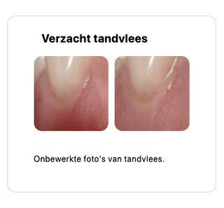 REGENERATING tandvlees serum-gel - Bio'ty Lab