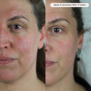 Facial oil PAX - sensitive &amp; acne skin